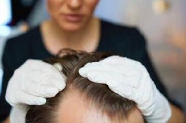 Repousse cheveux & poils (RegenX) à Marseille – Villa M